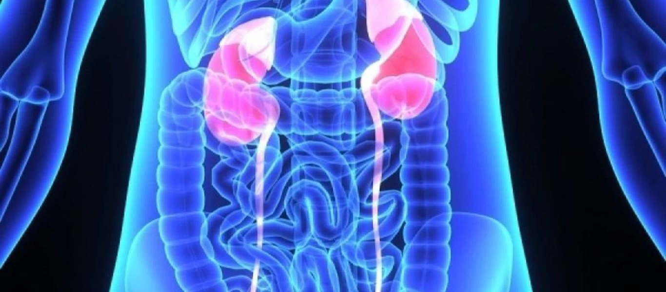 Πέτρες στα νεφρά: Προσοχή σε αυτά τα συμπτώματα - Πως θα φύγουν ανώδυνα (βίντεο)